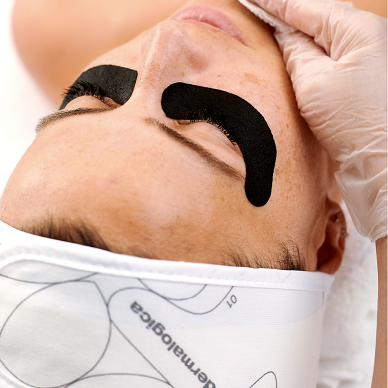 chemical peel treatment a skin brightening rejuvenating anti ageing facial