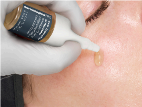 Exosomes Facial